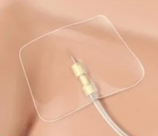 Kit de Fixation Cathéter Securfix Plus